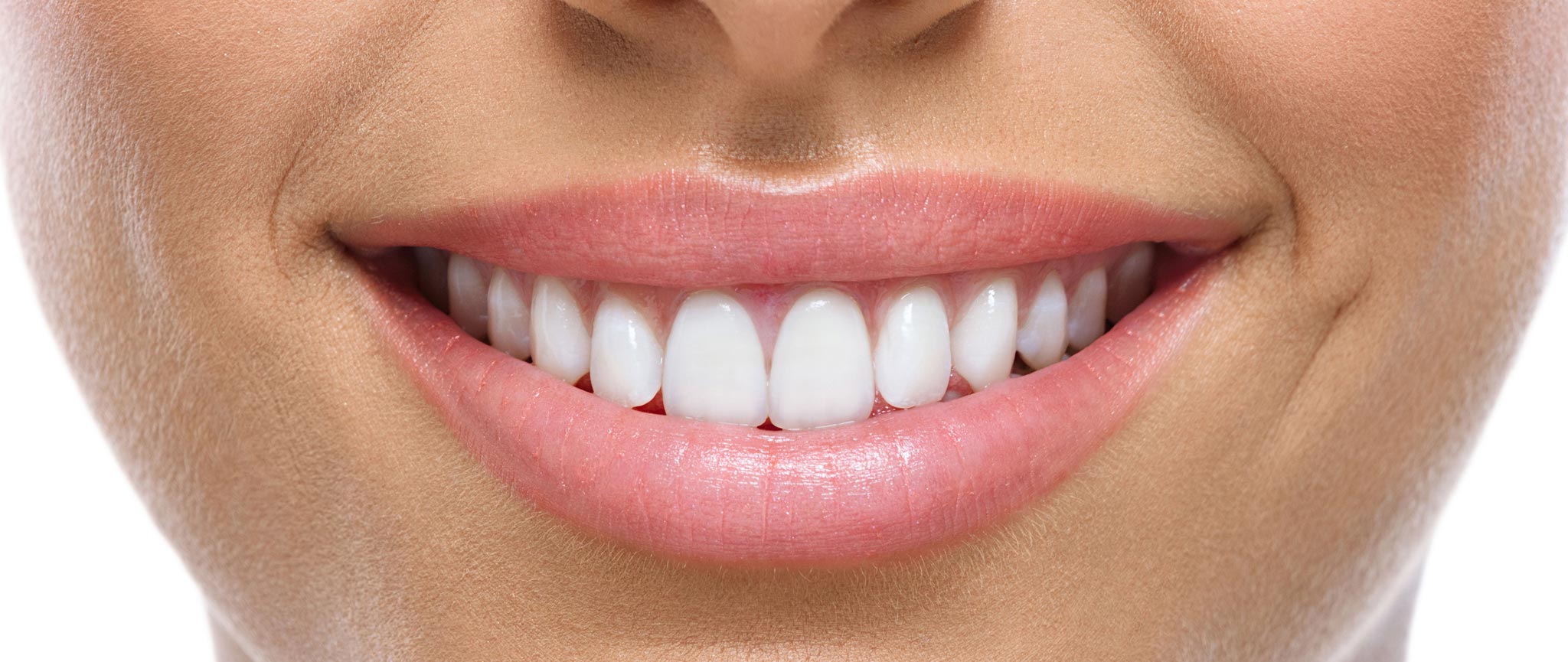 Carillas dentales: la solución estética