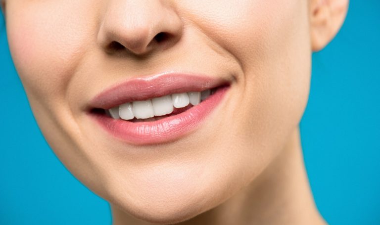 implantes dentales
