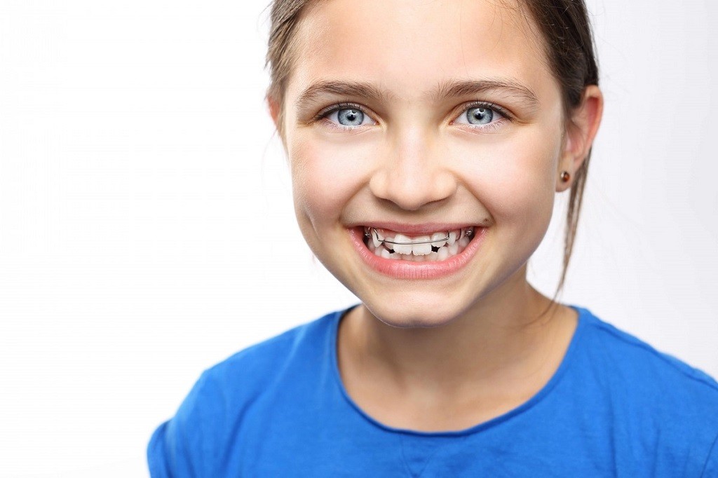 Ortodoncia interceptiva para niños