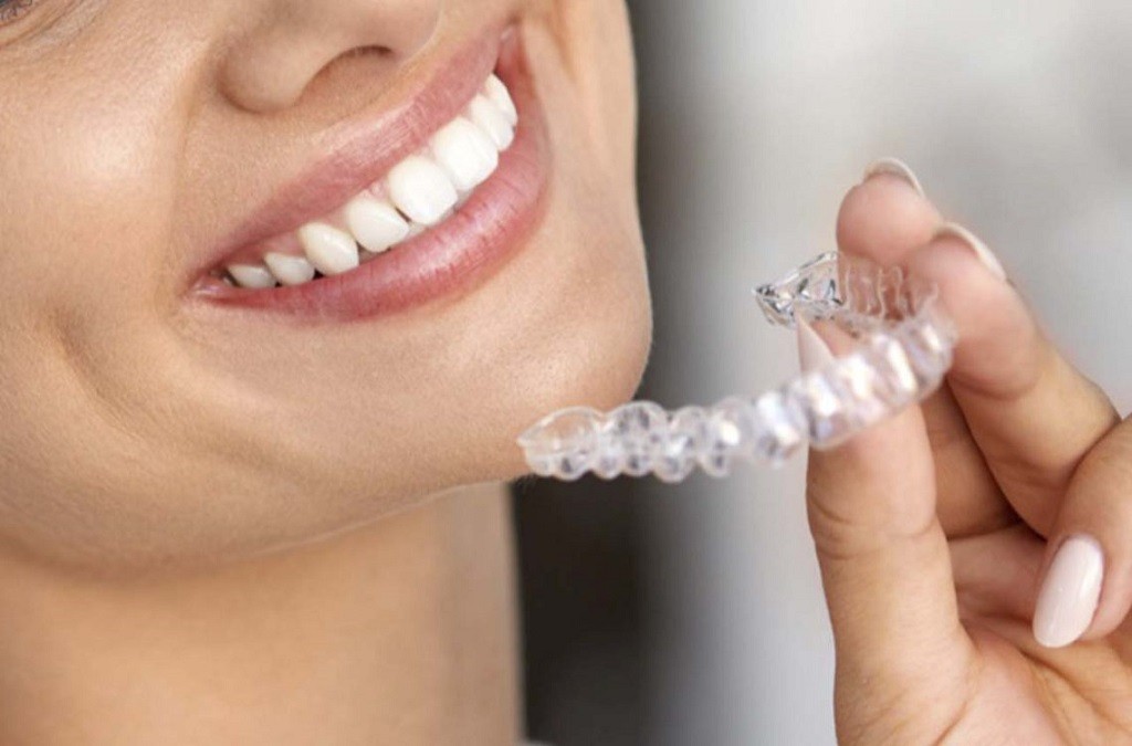 La revolución de la ortodoncia